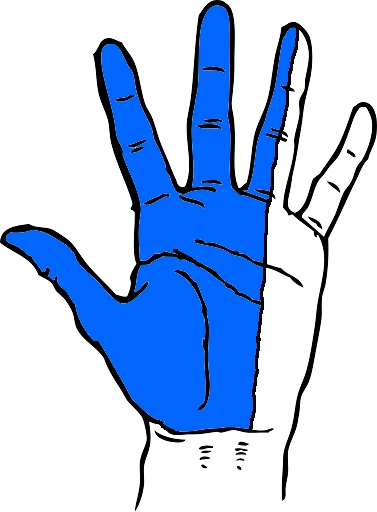 The part of the hand usually affected in CTS